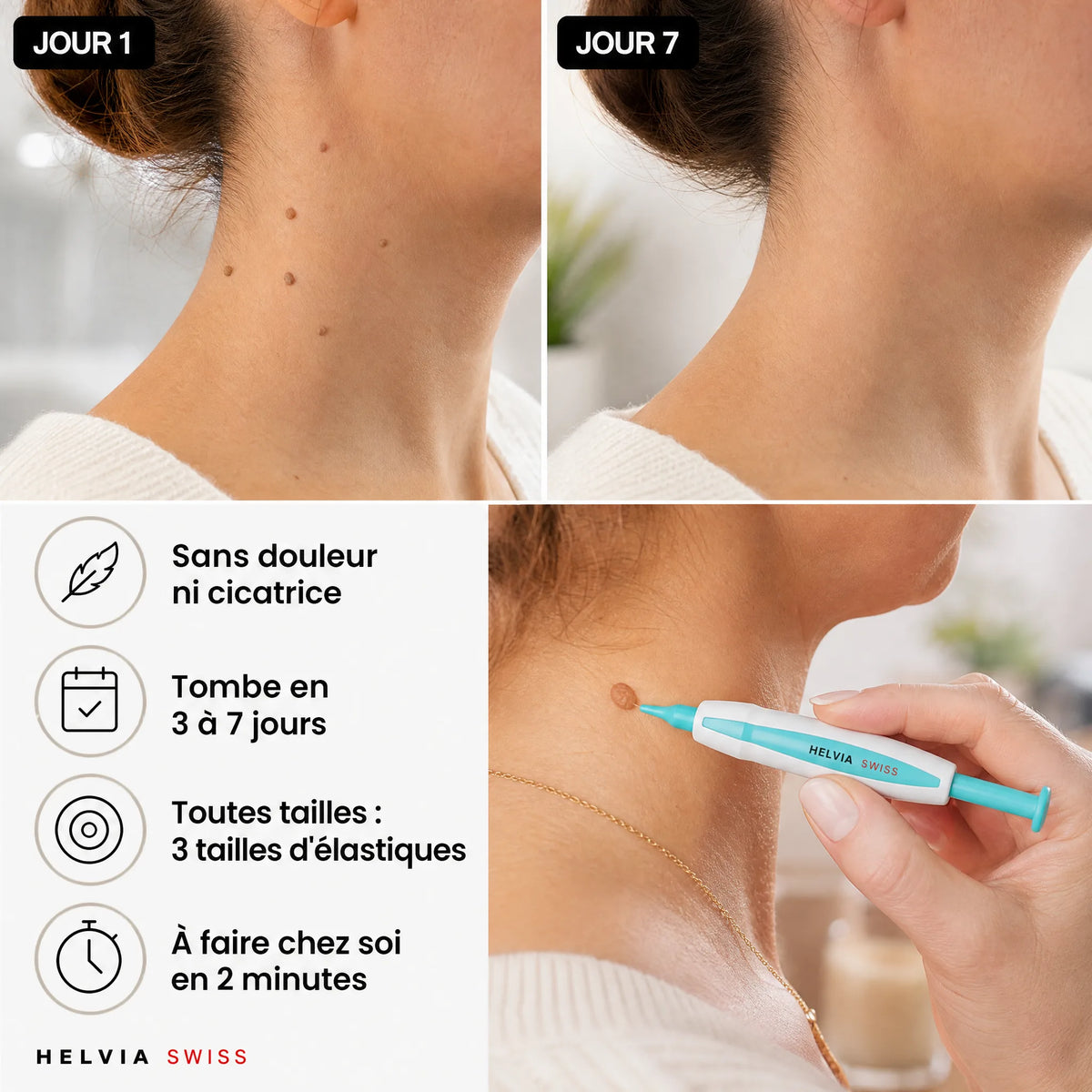 Kit Anti-Acrochordons — HELVIA SWISS