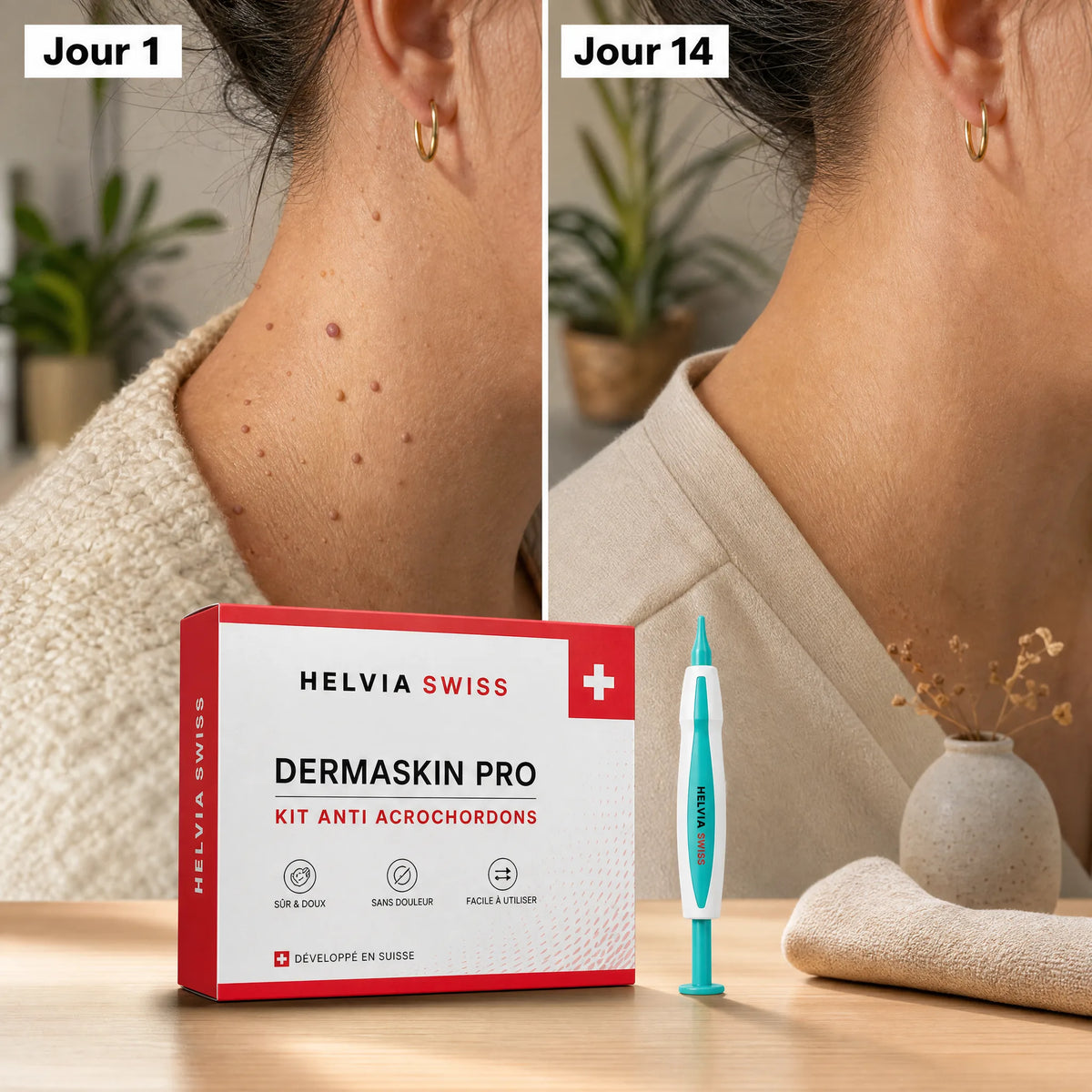 Kit Anti-Acrochordons — HELVIA SWISS