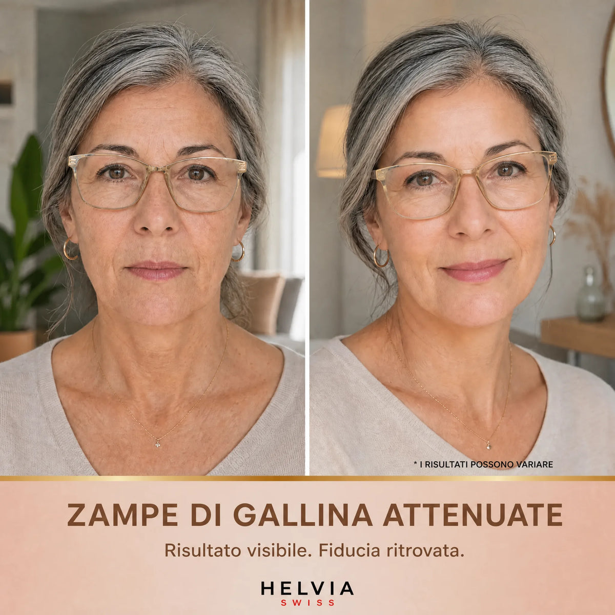 Siero Liftante Peptidi di Seta HELVIA SWISS
