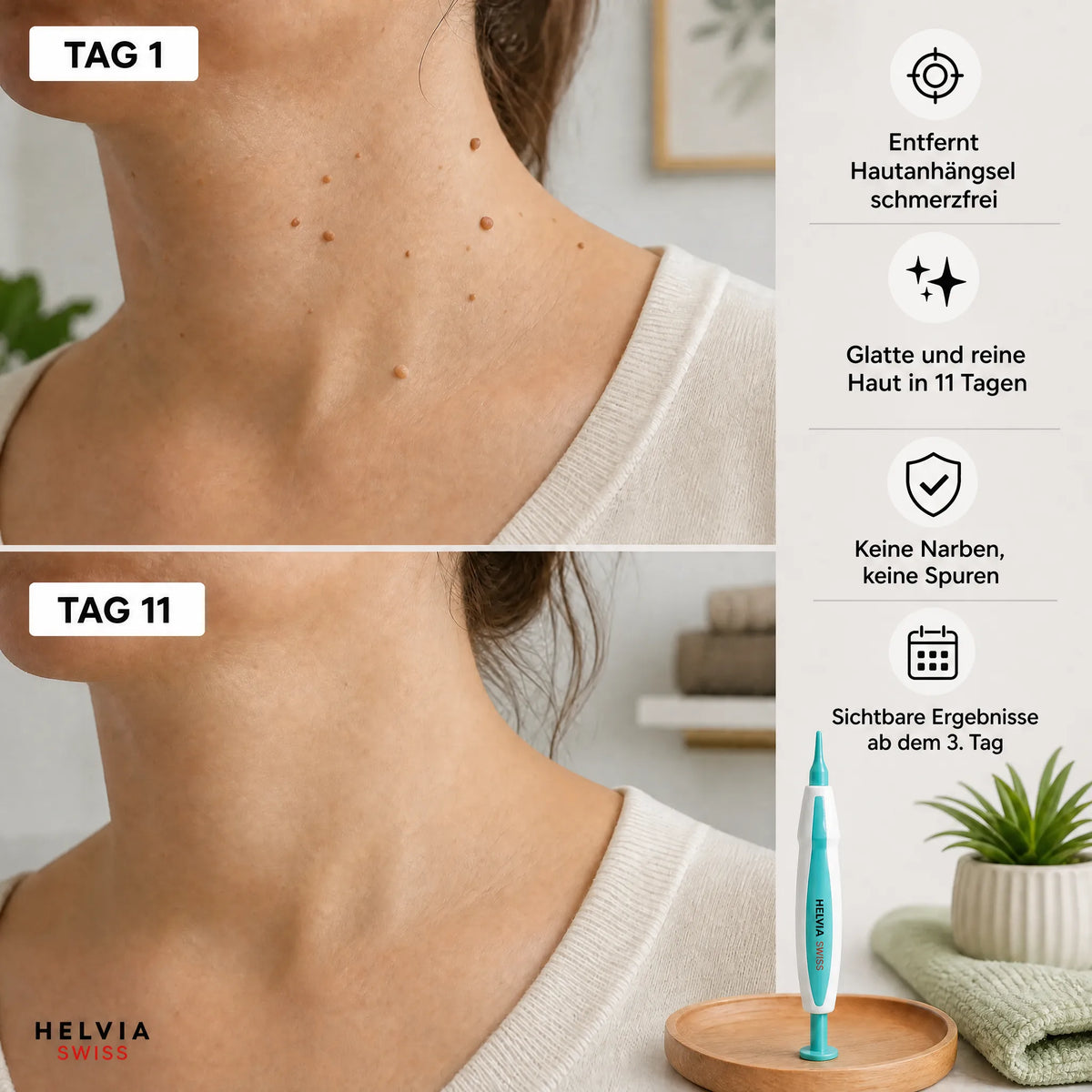 Anti-Hautanhängsel Kit — HELVIA SWISS