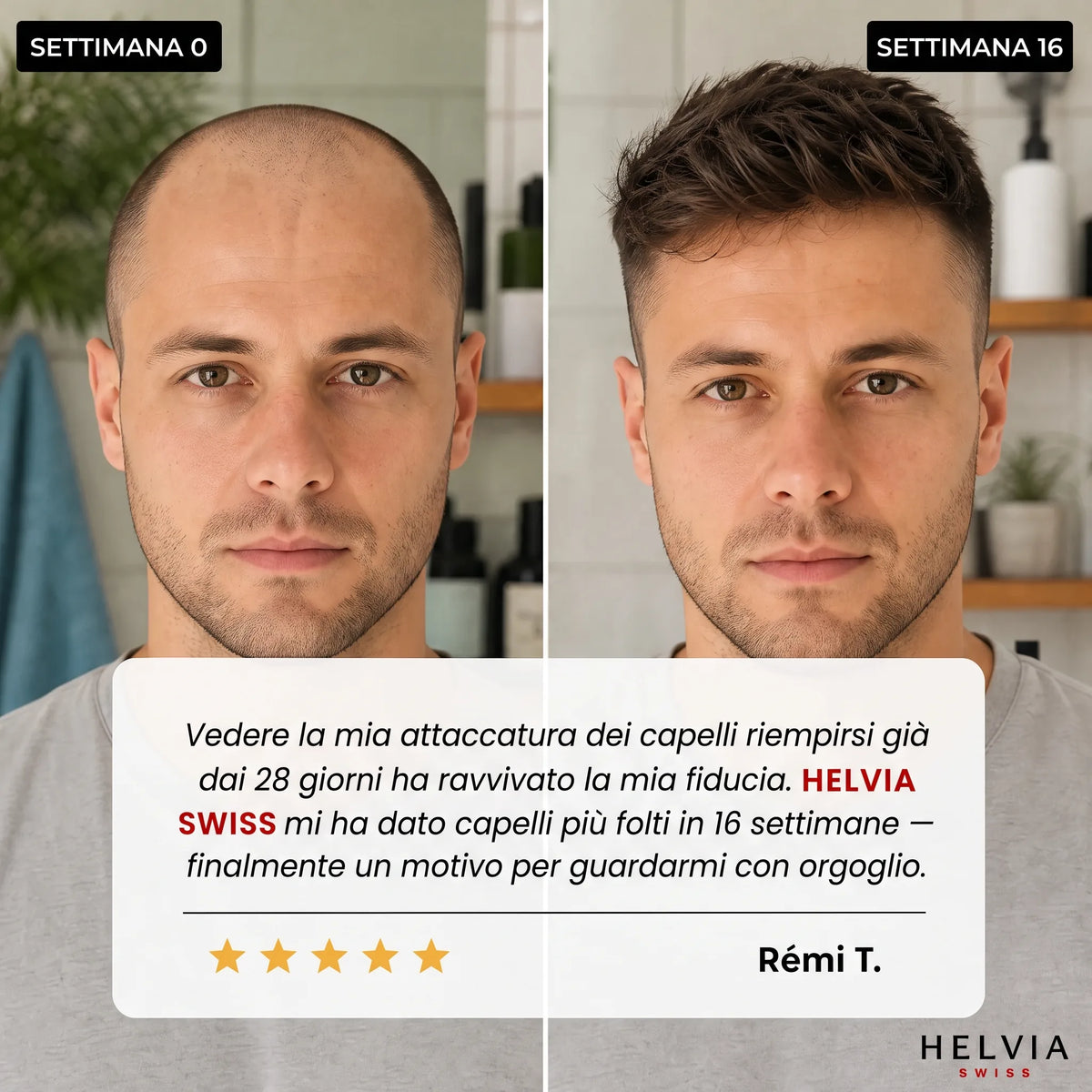 Siero Roll-On Ricrescita Capillare HELVIA SWISS