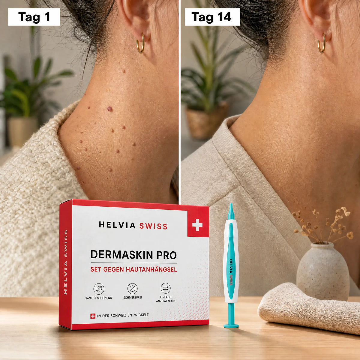 Anti-Hautanhängsel Kit — HELVIA SWISS