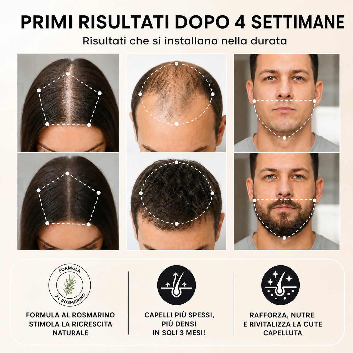 Siero Roll-On Ricrescita Capillare HELVIA SWISS