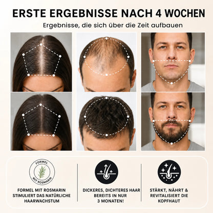 Haarwuchs Roll-On Serum HELVIA SWISS