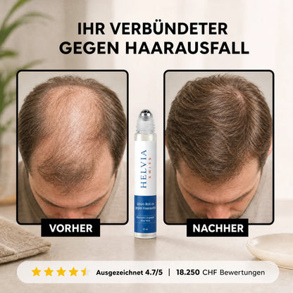 Haarwuchs Roll-On Serum HELVIA SWISS