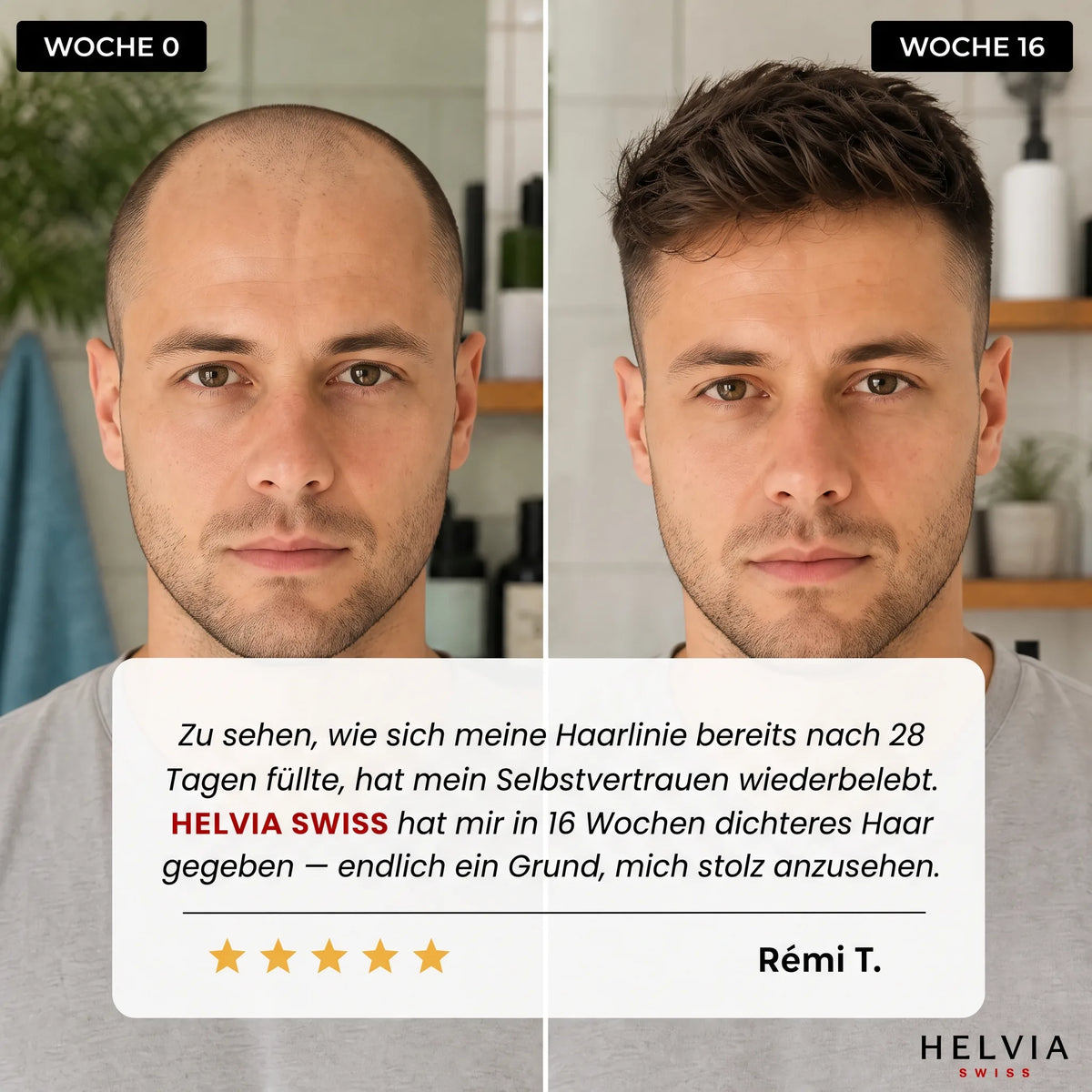 Haarwuchs Roll-On Serum HELVIA SWISS