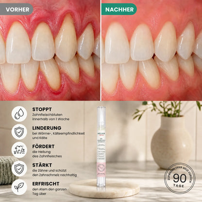Zahnfleisch-Repair-Gel HELVIA SWISS