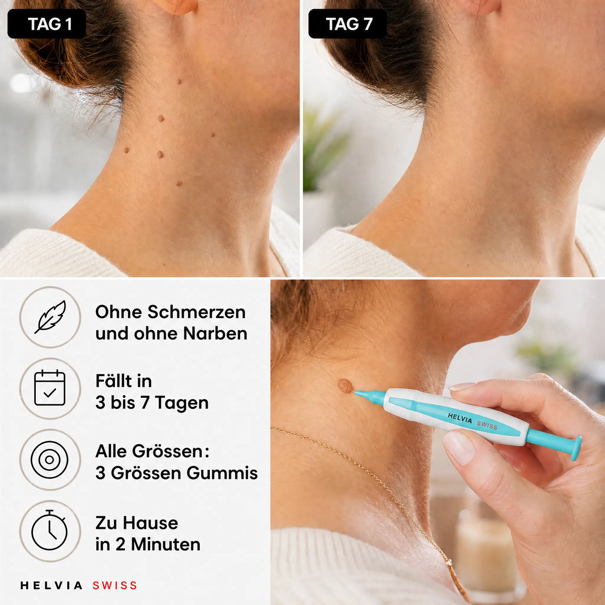 Anti-Hautanhängsel Kit — HELVIA SWISS