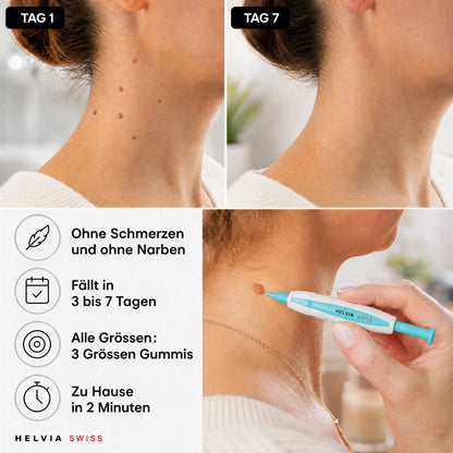Anti-Hautanhängsel Kit — HELVIA SWISS