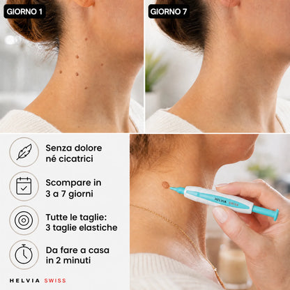 Kit Anti-Acrocordoni — HELVIA SWISS